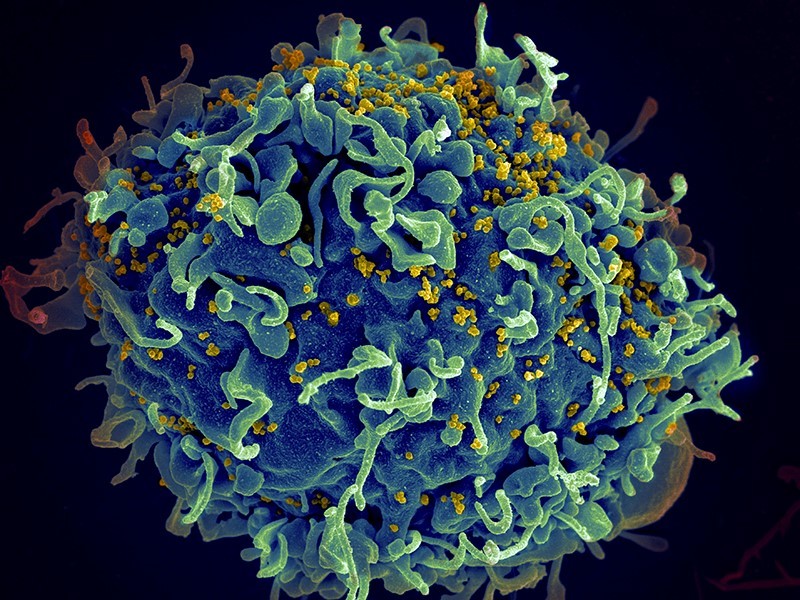 Combination treatment for immune-mediated HIV remission