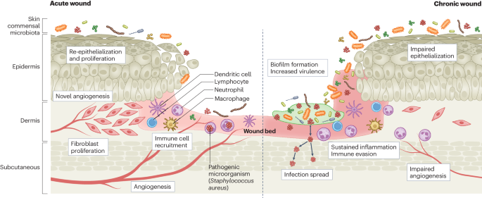 The wound microbiota: microbial mechanisms of impaired wound healing and infection