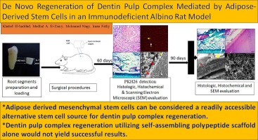 De novo regeneration of dentin pulp complex mediated by Adipose derived stem cells in an immunodeficient albino rat model (Histological, histochemical and scanning electron microscopic Study)