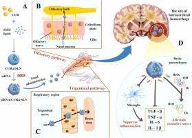 Curcumin/TGF-β1 siRNA loaded solid lipid nanoparticles alleviate cerebral injury after intracerebral hemorrhage by transnasal brain targeting