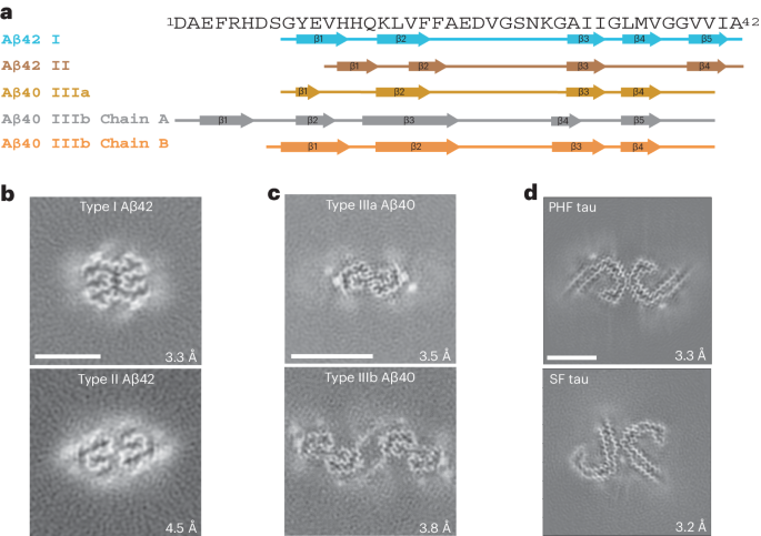 High-resolution structures of amyloid-β and tau aggregates in individuals with Down syndrome