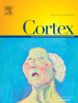 Visual attention patterns during a gaze following task in neurogenetic syndromes associated with unique profiles of autistic traits: Fragile X and Cornelia de Lange syndromes