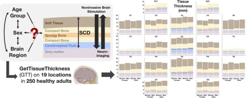Differences in scalp-to-cortex tissues across age groups, sexes and brain regions: Implications for neuroimaging and brain stimulation techniques