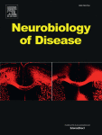 A nonlinear meccano for Alzheimer's emergence by amyloid β-mediated glutamatergic hyperactivity