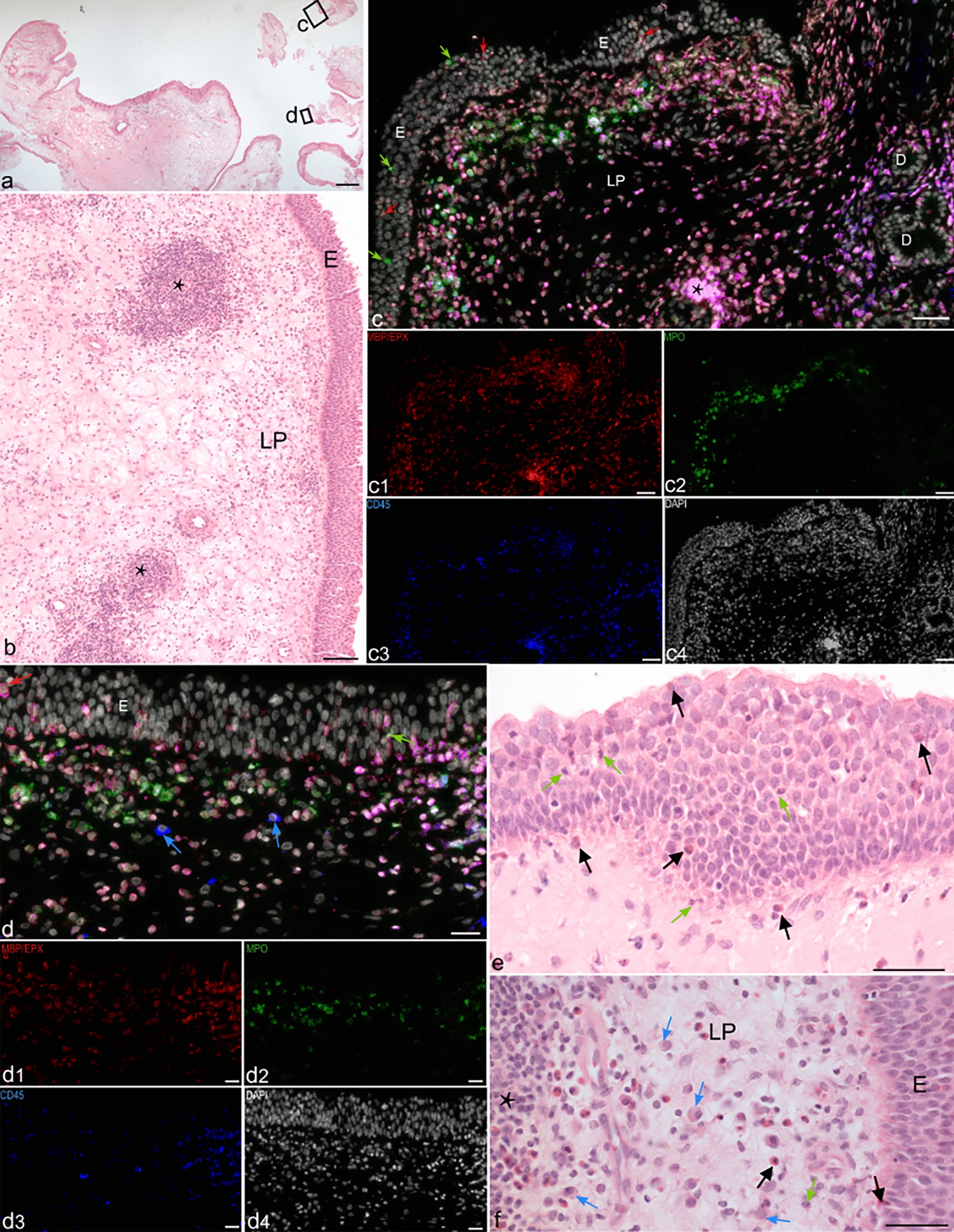 Identification of neutrophils and eosinophils in upper airway mucosa with immunofluorescence multiplex image cytometry