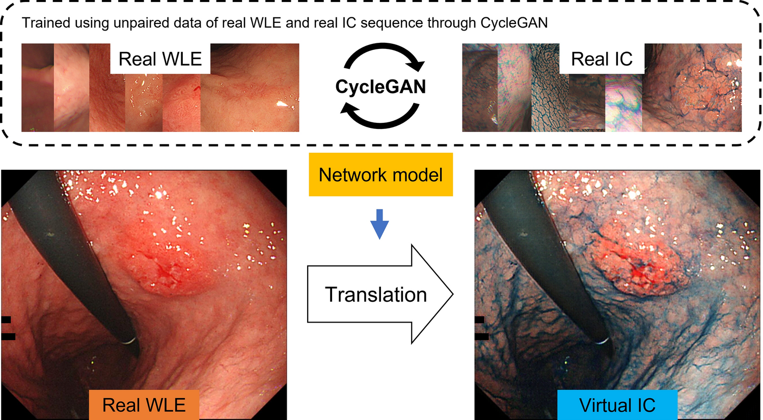 Diagnostic performance of deep-learning-based virtual chromoendoscopy in gastric neoplasms