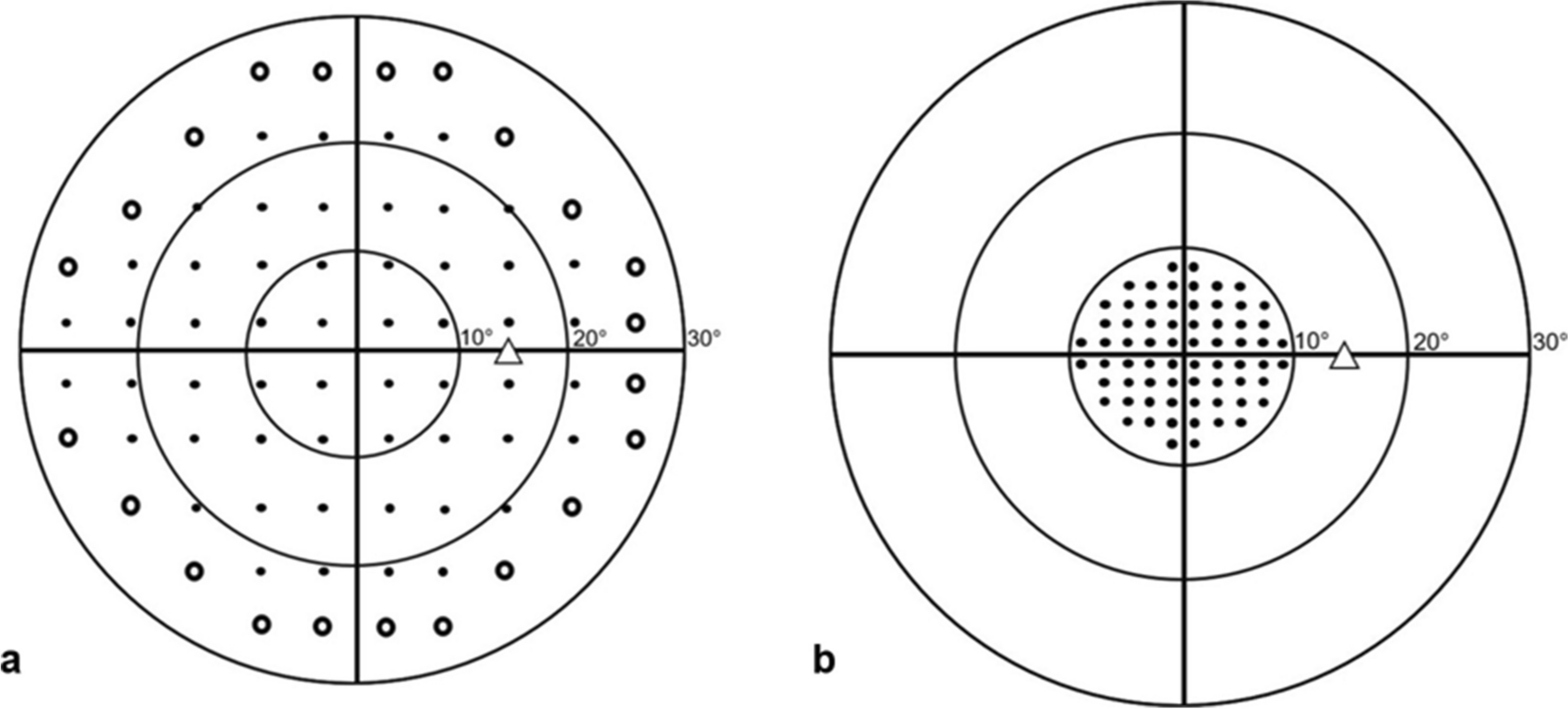 Interpretation of the Visual Field in Neuro-ophthalmic Disorders