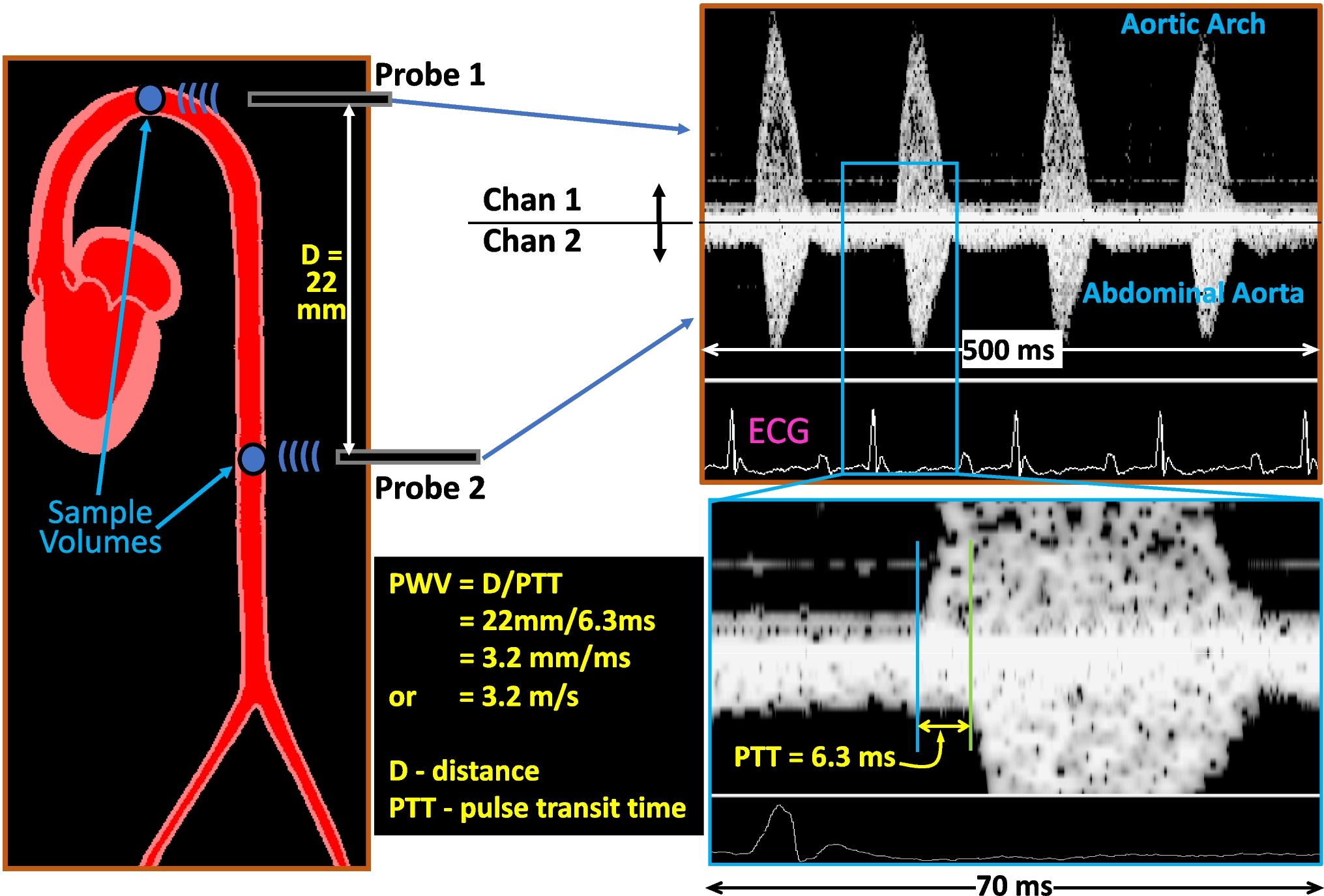 Update on the Use of Pulse Wave Velocity to Measure Age-Related Vascular Changes