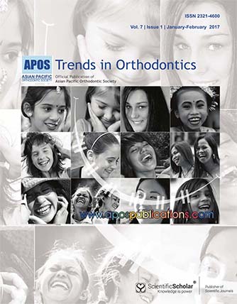 Autotransplanted premolars for substituting traumatic maxillary central incisors in a Class II growing patient