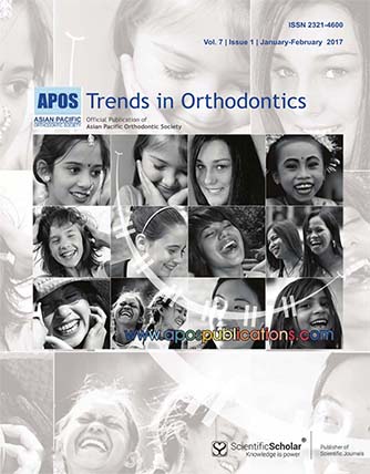 Accuracy of the infrazygomatic orthodontic bone screws digital planning and surgical guided positioning: A observational study