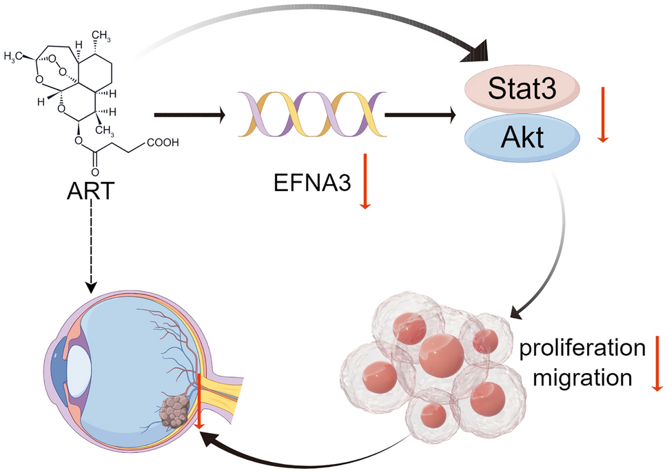 Artesunate attenuates the tumorigenesis of choroidal melanoma via inhibiting EFNA3 through Stat3/Akt signaling pathway