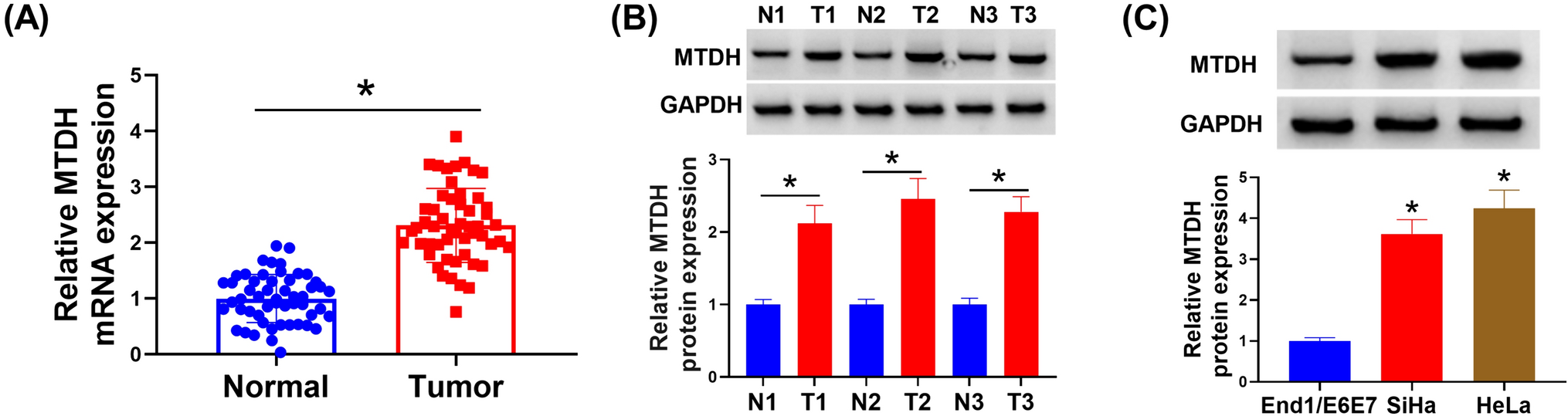 USP7 promotes cervical cancer progression by stabilizing MTDH expression through deubiquitination