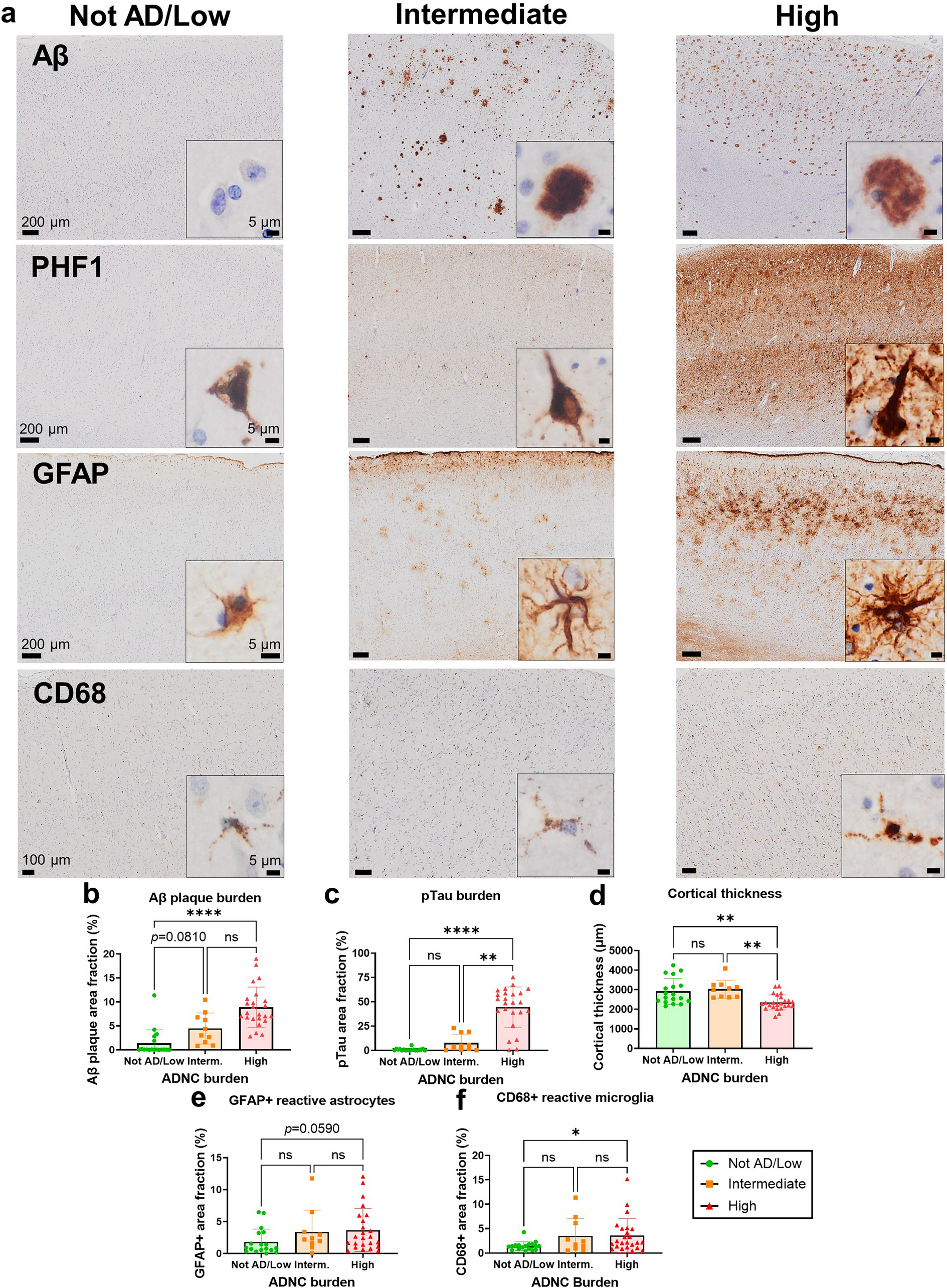 Characterization of monoamine oxidase-B (MAO-B) as a biomarker of reactive astrogliosis in Alzheimer’s disease and related dementias