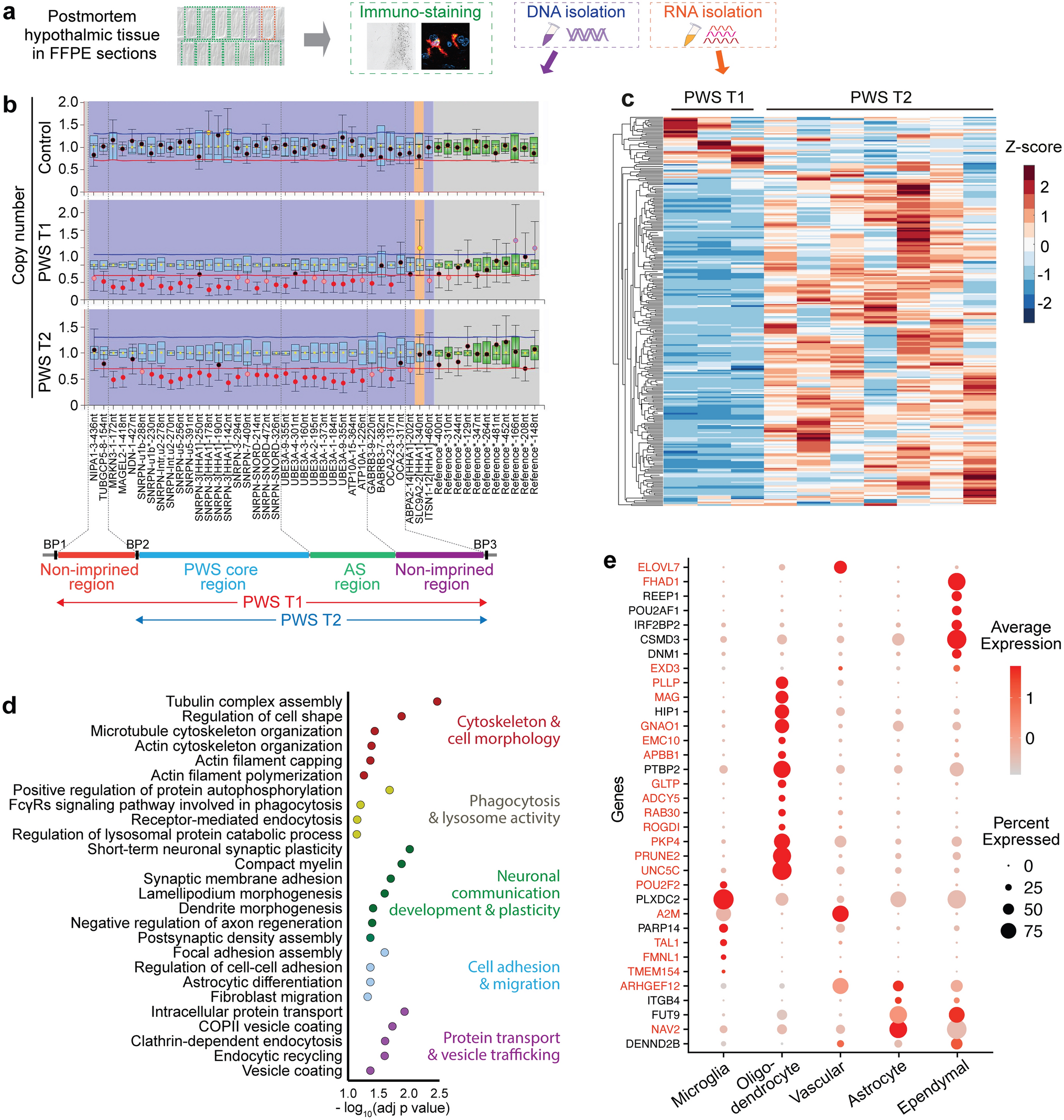 Microglial phagolysosome dysfunction and altered neural communication amplify phenotypic severity in Prader-Willi Syndrome with larger deletion