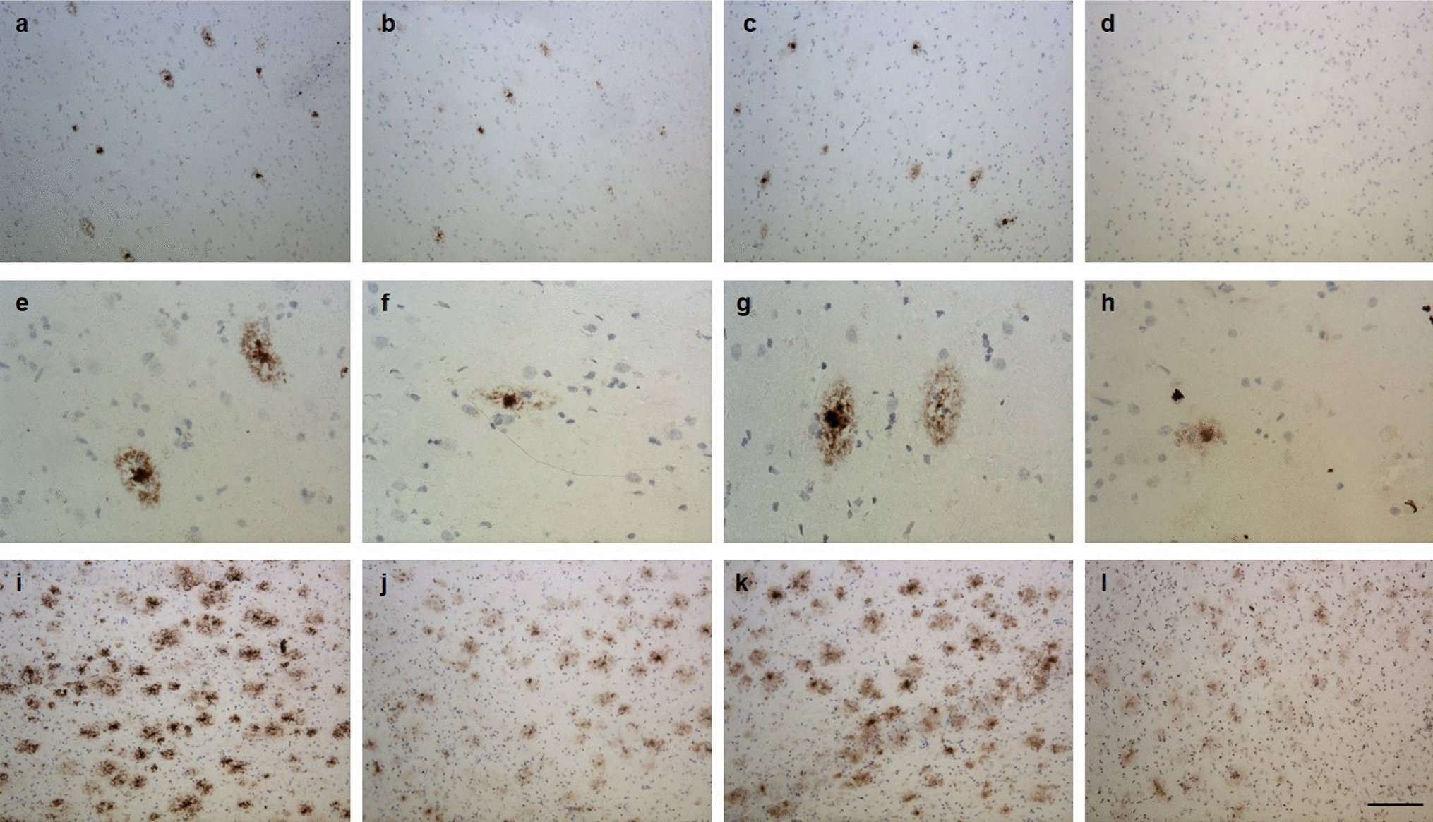 Correction: Abeta targets of the biosimilar antibodies of Bapineuzumab, Crenezumab, Solanezumab in comparison to an antibody against N-truncted Abeta in sporadic Alzheimer disease cases and mouse models