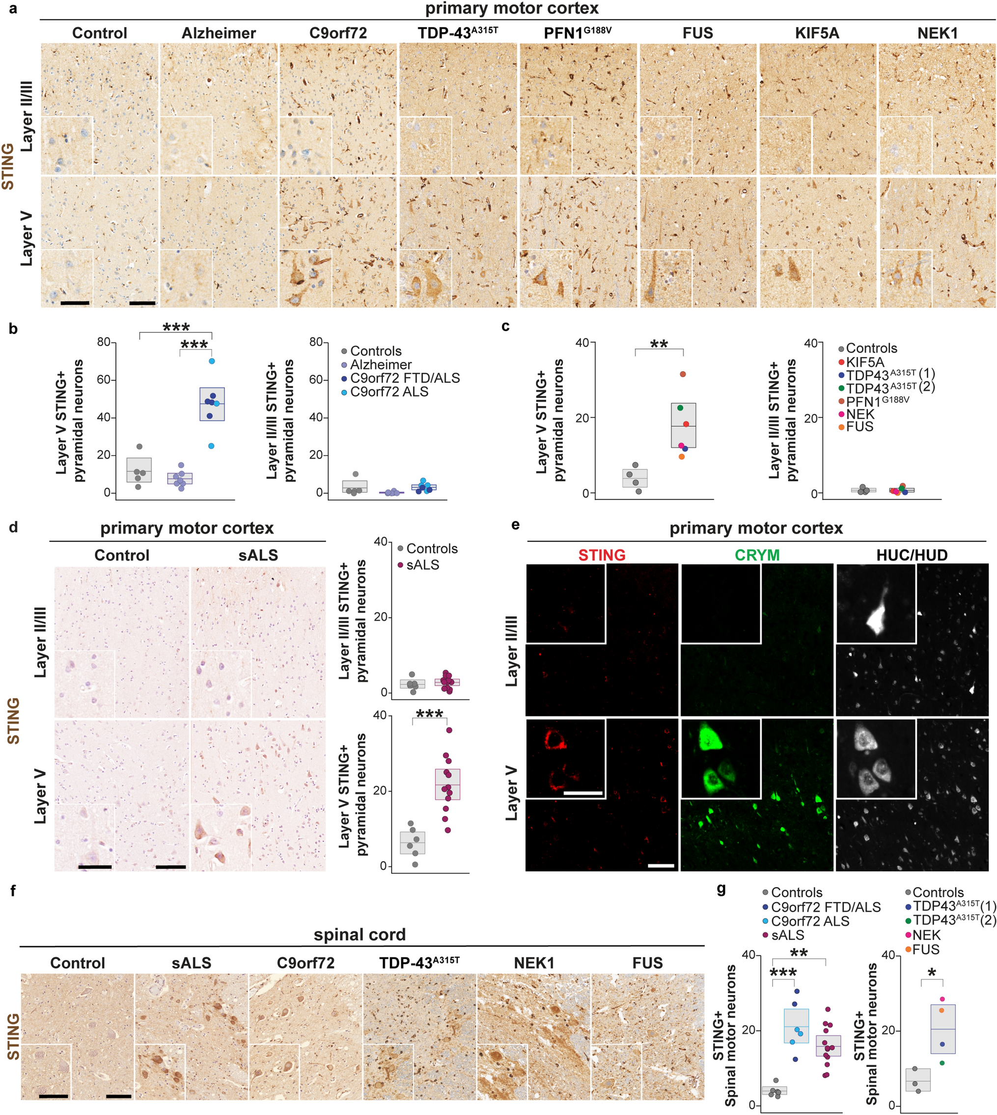 Neuronal STING activation in amyotrophic lateral sclerosis and frontotemporal dementia