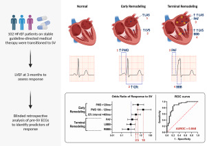 Electrocardiographic predictors of response to sacubitril/valsartan therapy in heart failure with reduced ejection fraction