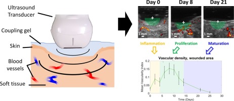 Contrast-Free High Frame Rate Ultrasound Imaging for Assessment of Vascular Remodeling During Wound Healing