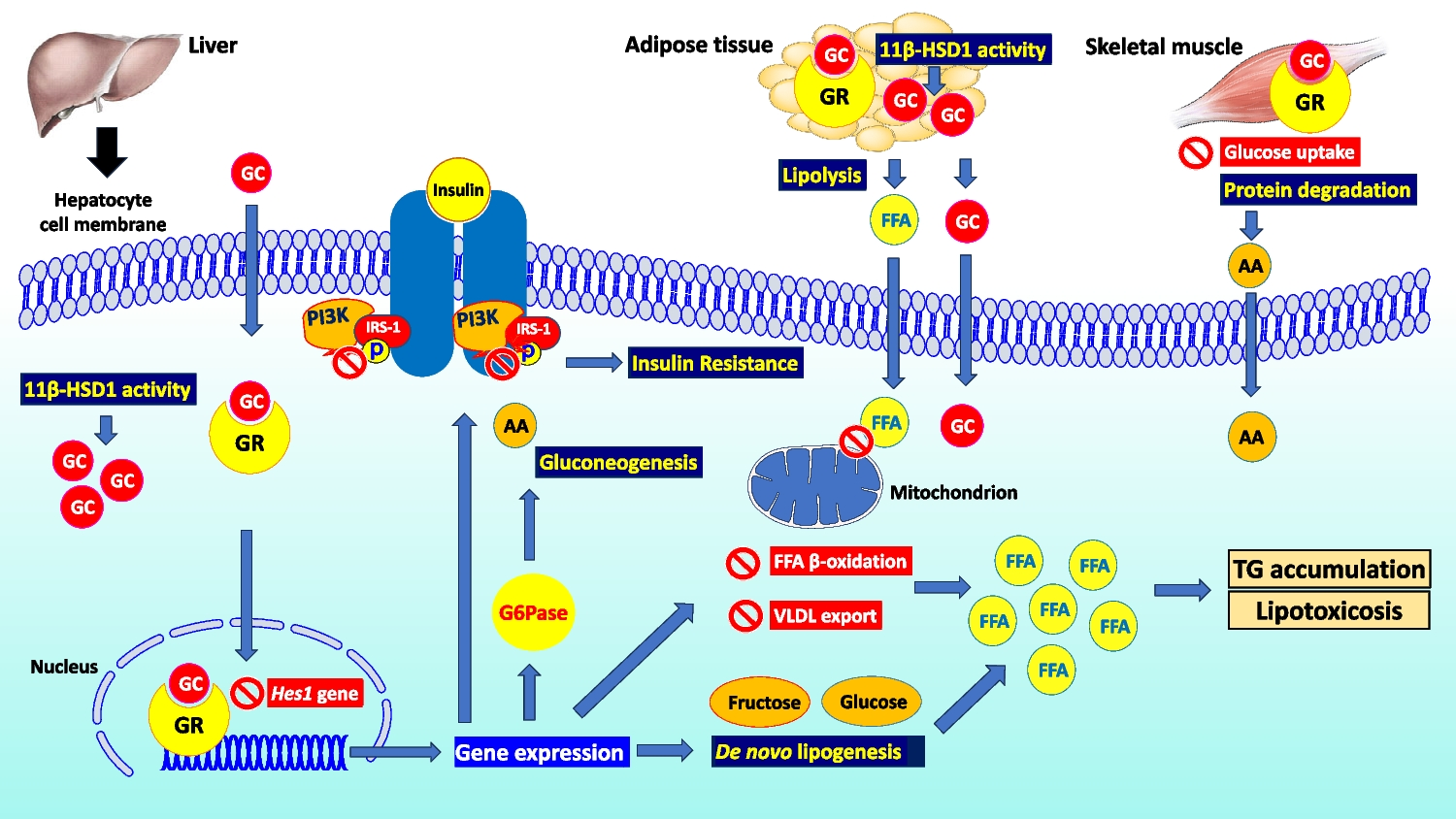 Role of Glucocorticoids in Metabolic Dysfunction-Associated Steatotic Liver Disease