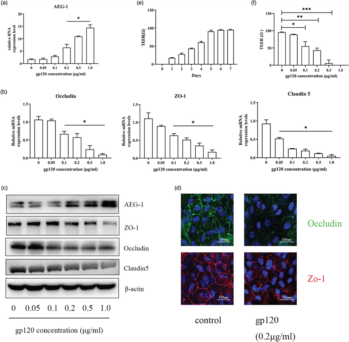HIV-1 gp120 amplifies astrocyte elevated gene-1 activity to compromise the integrity of the outer blood–retinal barrier