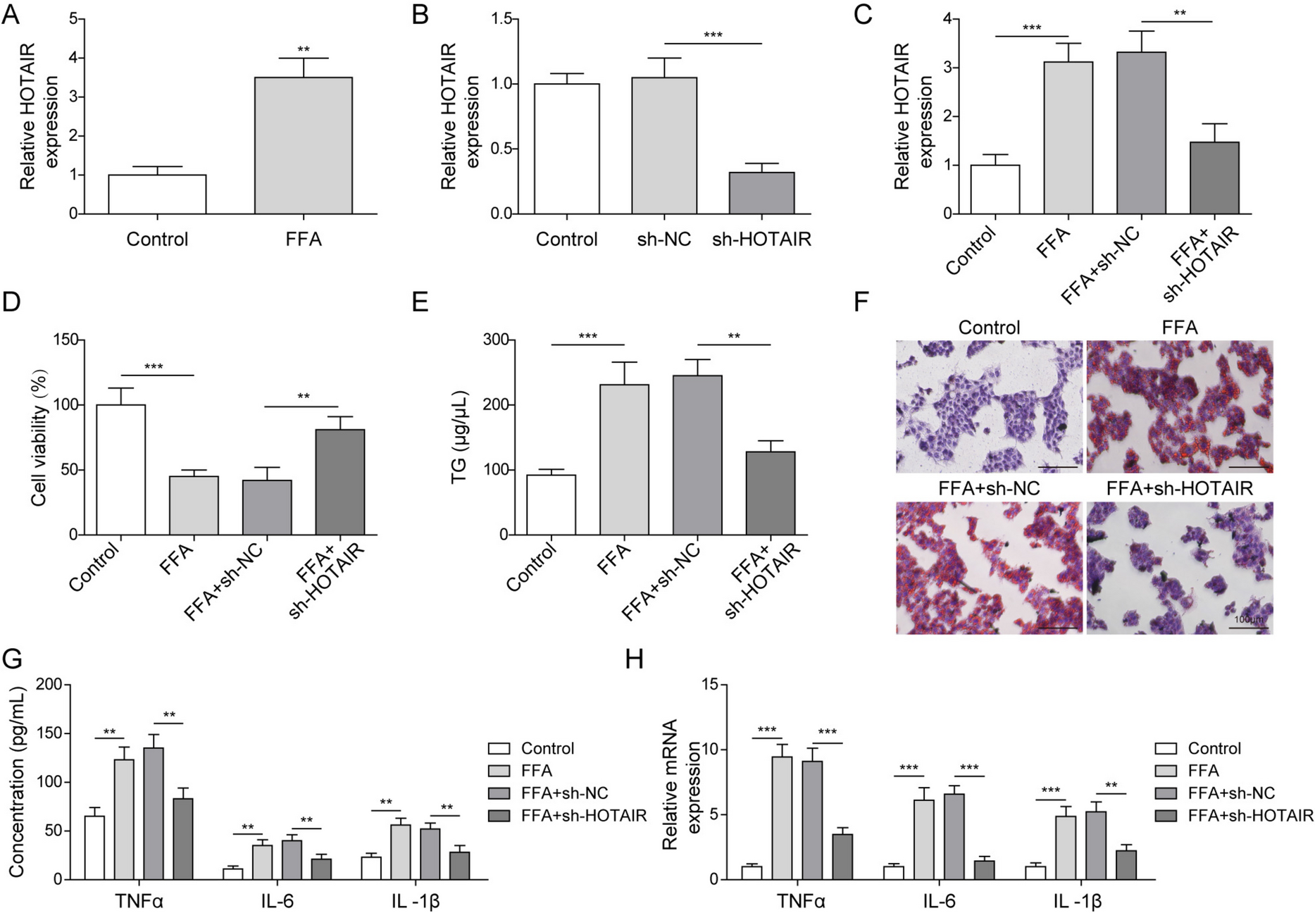 LncRNA HOTAIR accelerates free fatty acid-induced inflammatory response in HepG2 cells by recruiting SRSF1 to stabilize MLXIPL mRNA