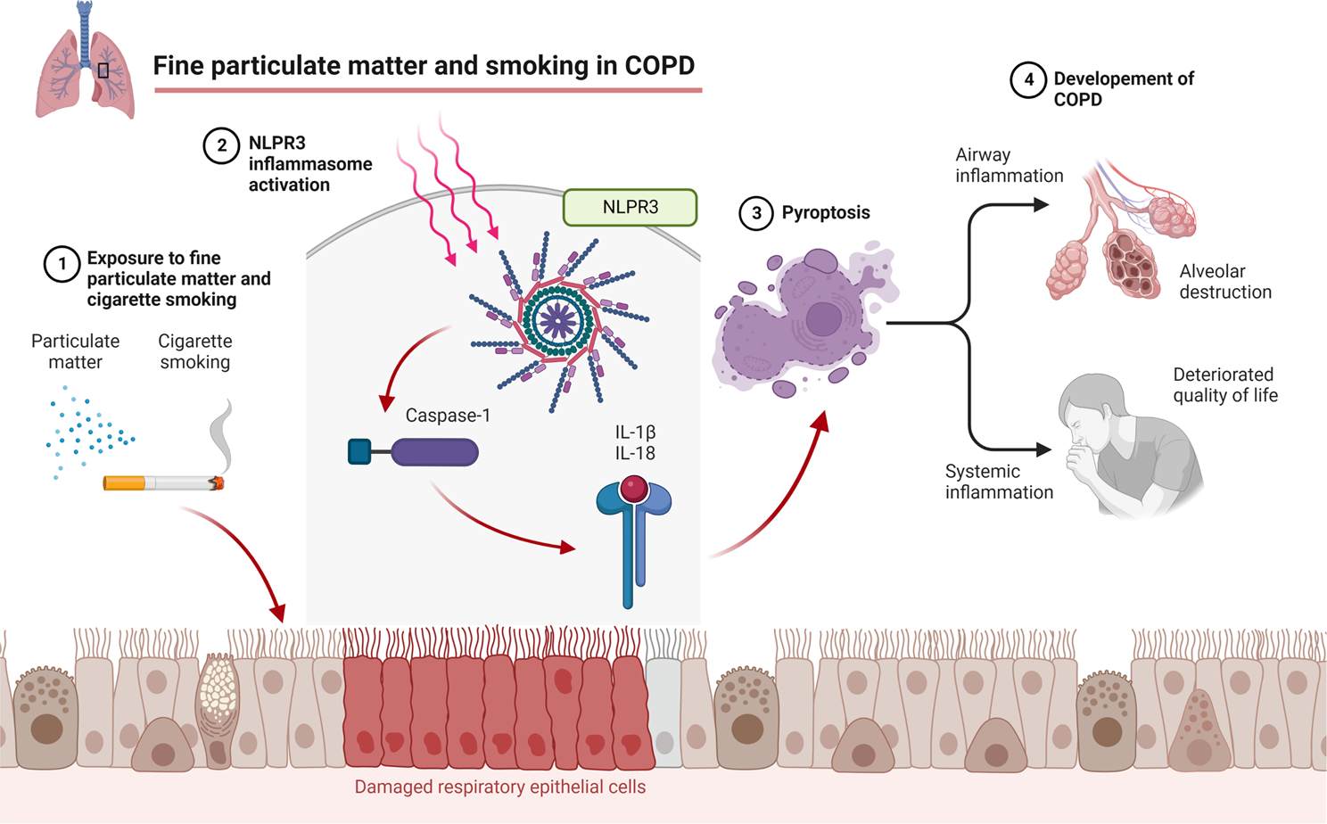 Fine particulate matter aggravates smoking induced lung injury via NLRP3/caspase-1 pathway in COPD