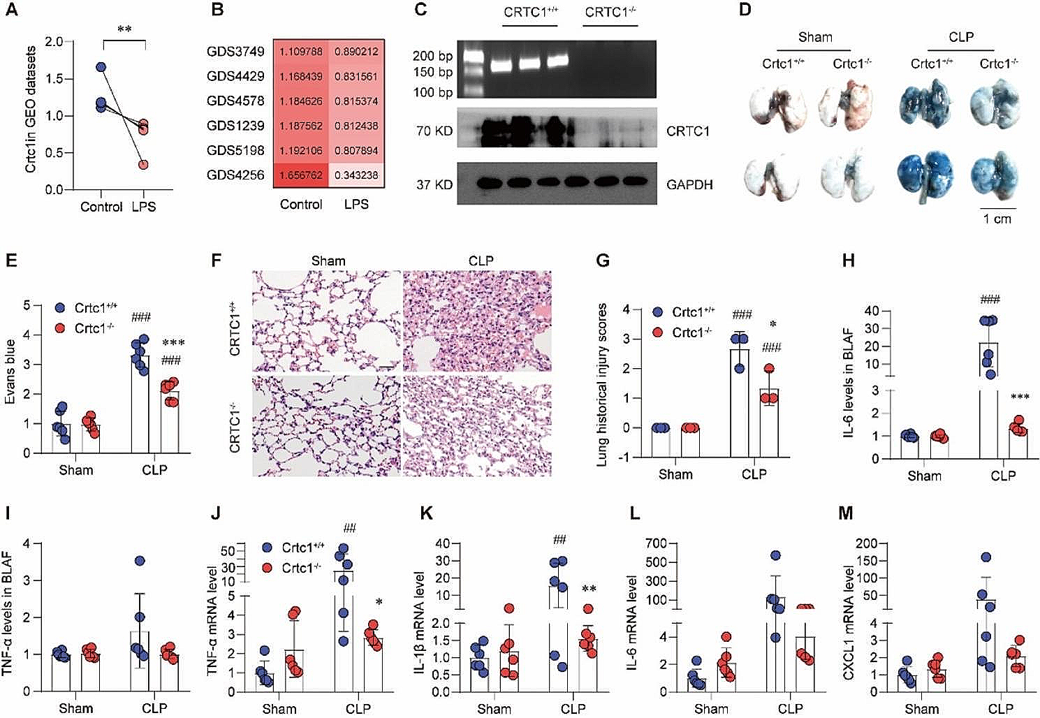 Crtc1 deficiency protects against sepsis-associated acute lung injury through activating akt signaling pathway