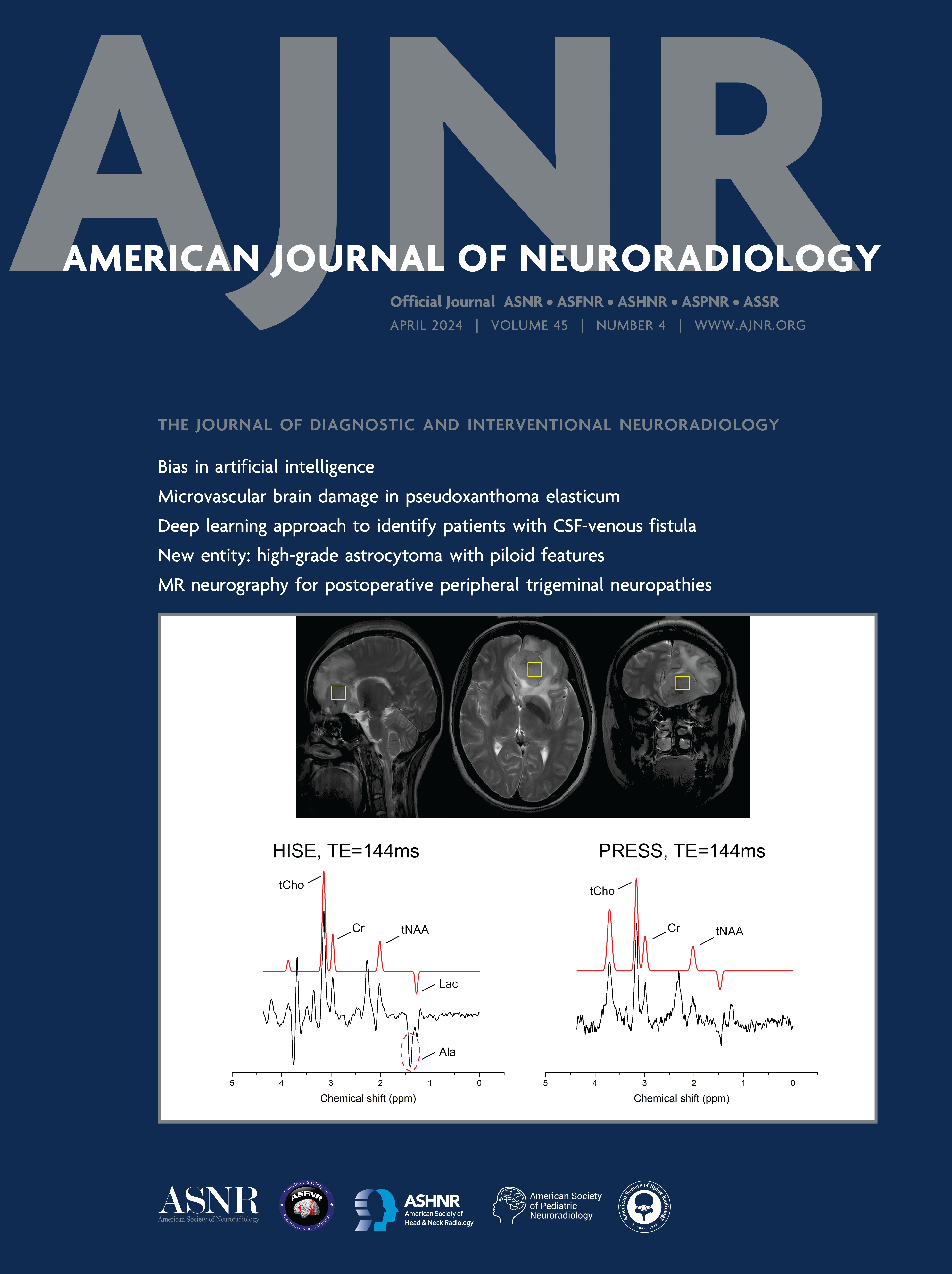 The Management of Persistent Distal Occlusions after Mechanical Thrombectomy and Thrombolysis: An Inter- and Intrarater Agreement Study [NEUROVASCULAR/STROKE IMAGING]