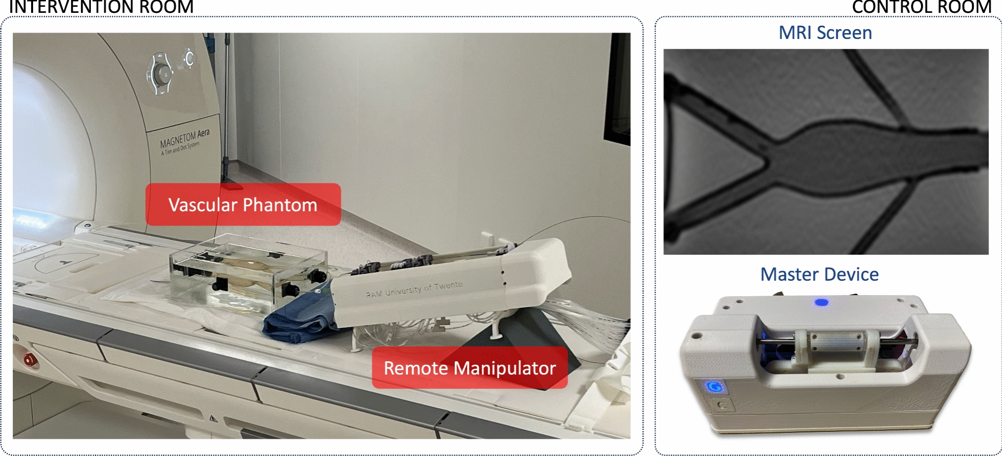 MR-based navigation for robot-assisted endovascular procedures
