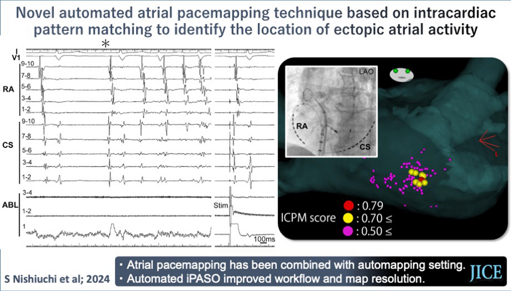 Novel automated atrial pacemapping technique based on intracardiac pattern matching to identify the location of ectopic atrial activity