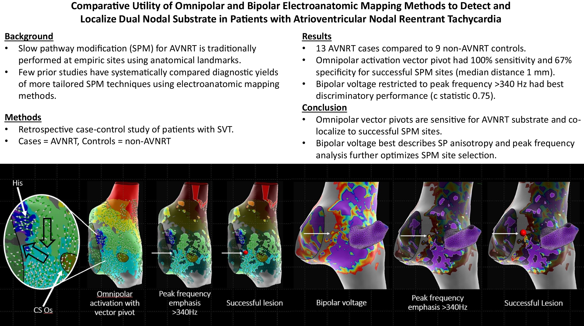Comparative utility of omnipolar and bipolar electroanatomic mapping methods to detect and localize dual nodal substrate in patients with atrioventricular nodal reentrant tachycardia