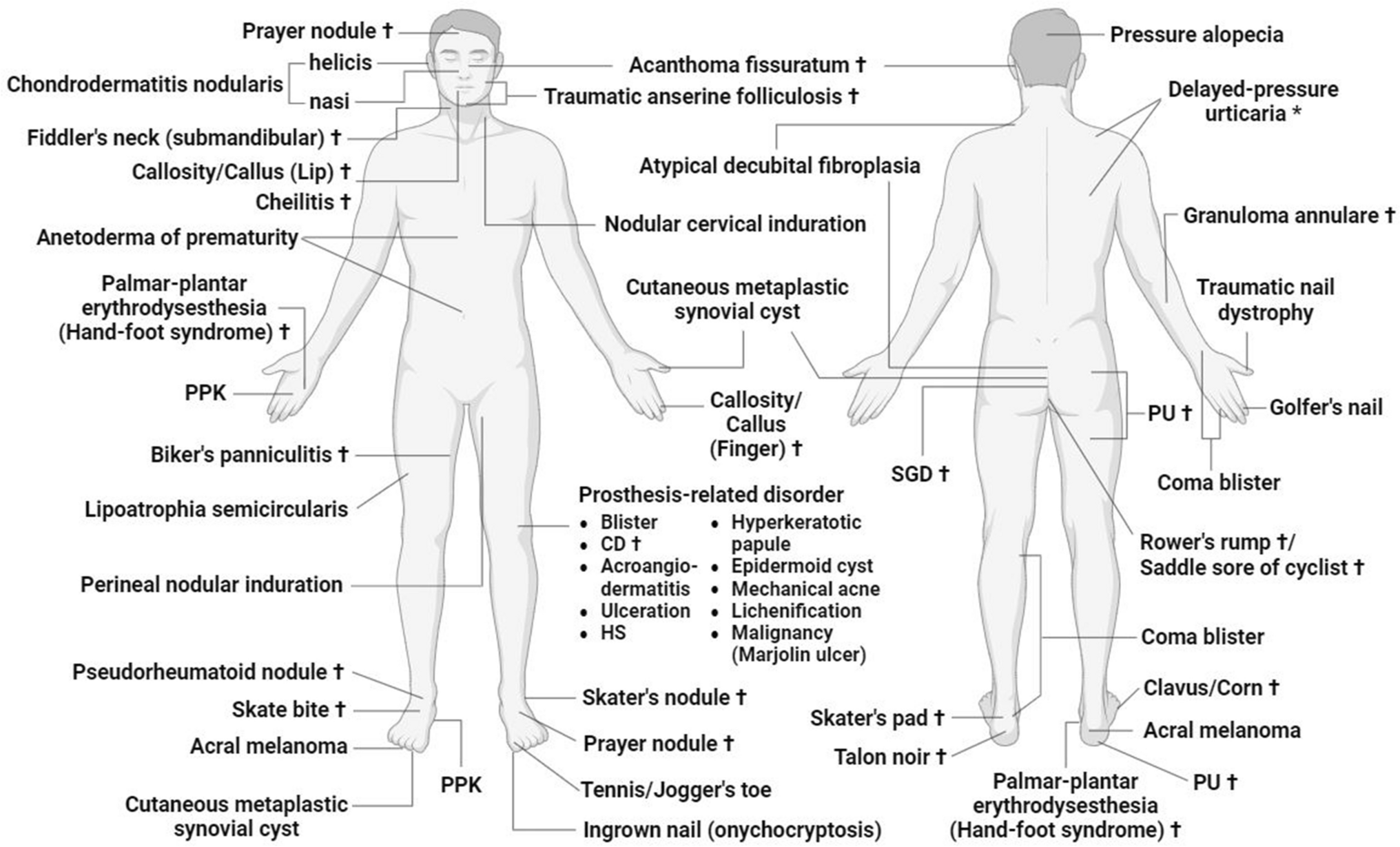 Pressure and Skin: A Review of Disease Entities Driven or Influenced by Mechanical Pressure