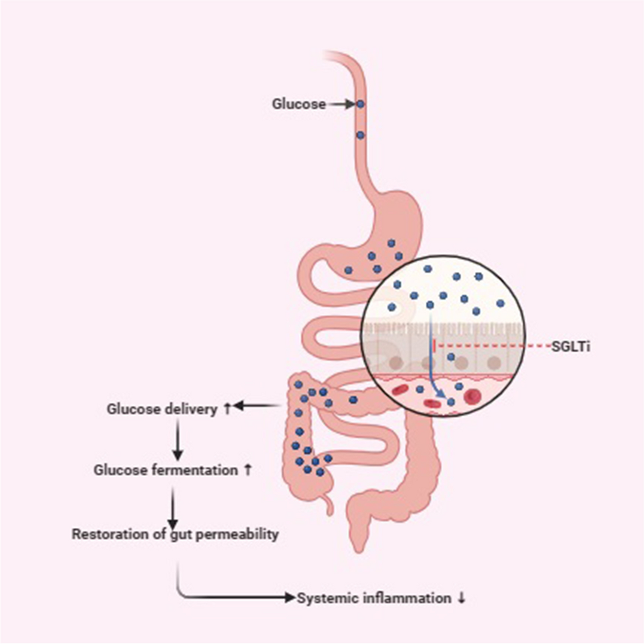 The impact of sodium-glucose cotransporter inhibitors on gut microbiota: a scoping review