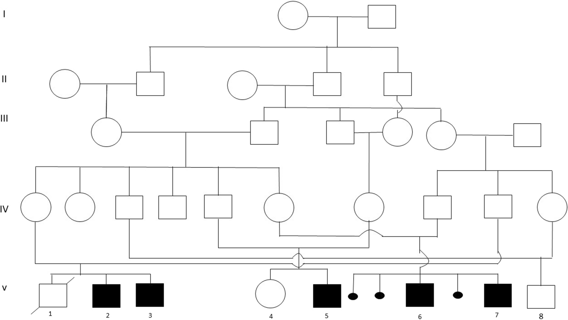 ADGRG1-related polymicrogyria syndrome: report on a large consanguineous family with a novel variant and review