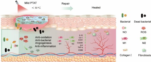 A hyaluronic acid hydrogel as a mild photothermal antibacterial, antioxidant, and nitric oxide release platform for diabetic wound healing