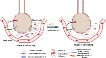 Cell selective BCL-2 inhibition enabled by lipid nanoparticles alleviates lung fibrosis