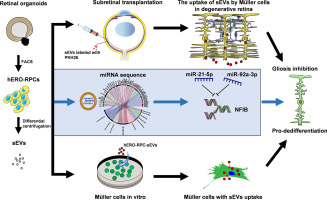 Small extracellular vesicles of organoid-derived human retinal stem cells remodel Müller cell fate via miRNA: A novel remedy for retinal degeneration