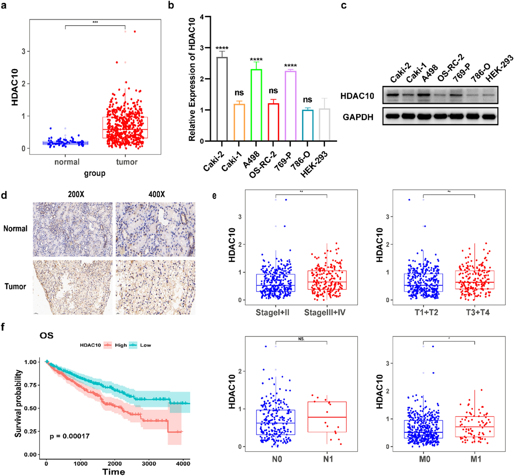 Elevated histone deacetylase 10 expression promotes the progression of clear cell renal cell carcinoma by Notch-1-PTEN signaling axis