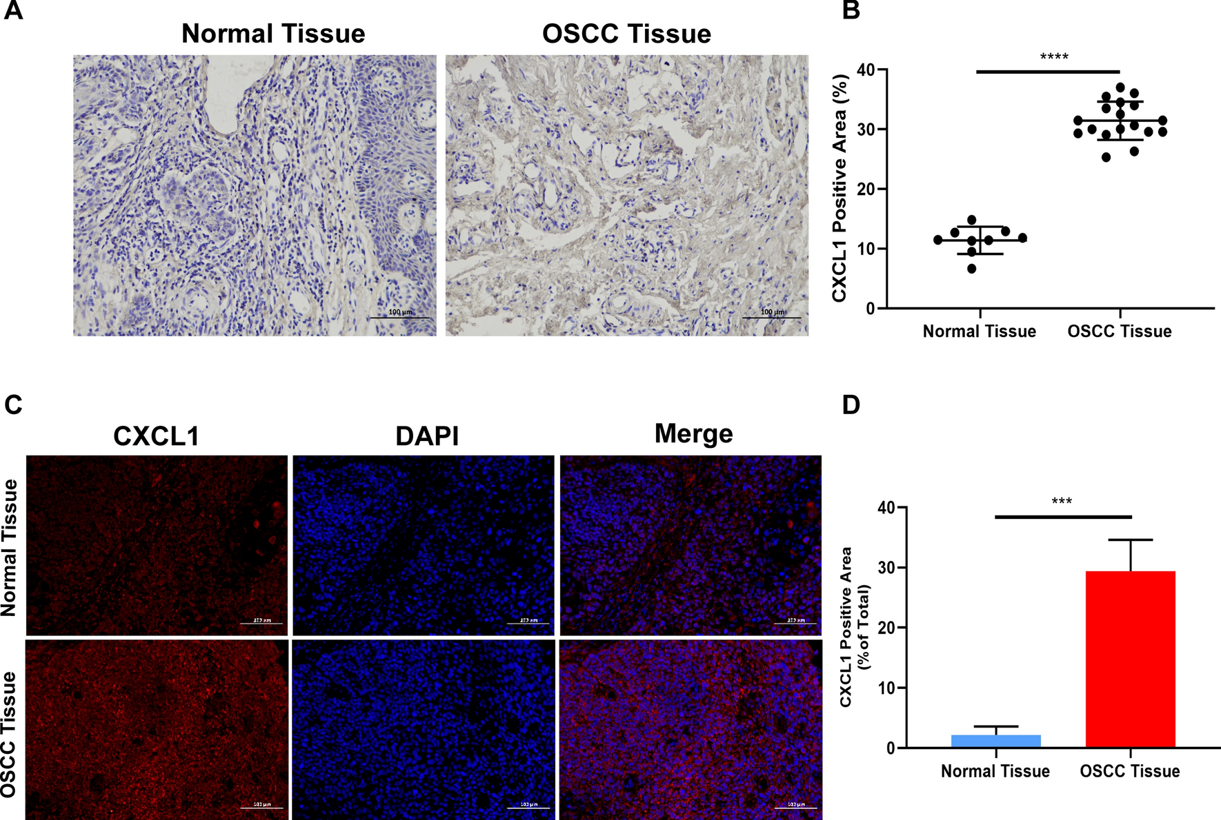 Crosstalk between cancer cells and macrophages promotes OSCC cell migration and invasion through a CXCL1/EGF positive feedback loop