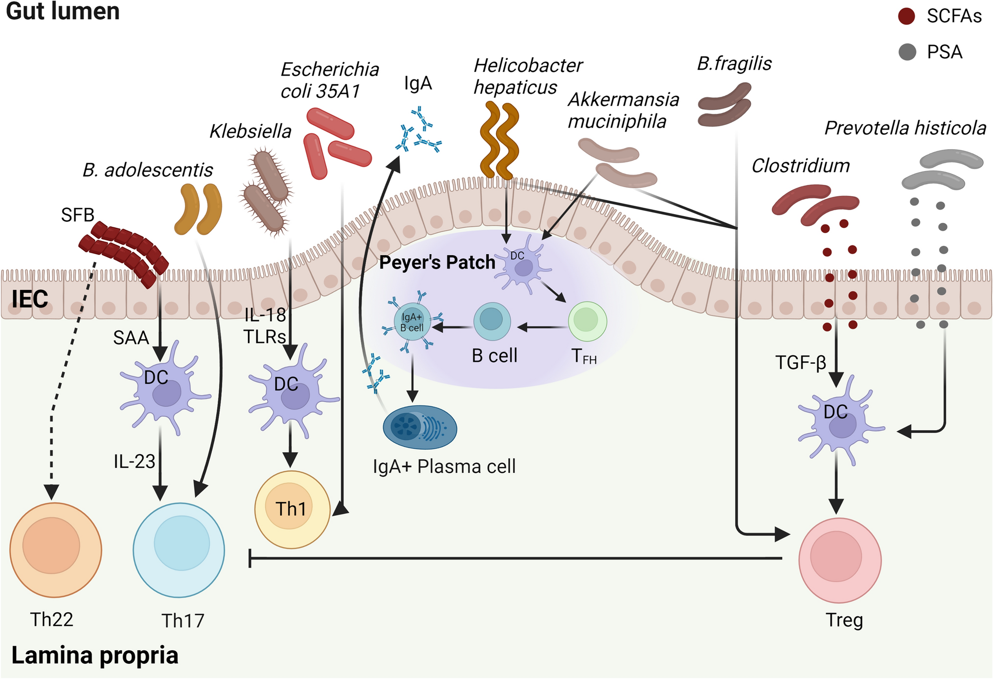 Targeting gut microbiota for immunotherapy of diseases