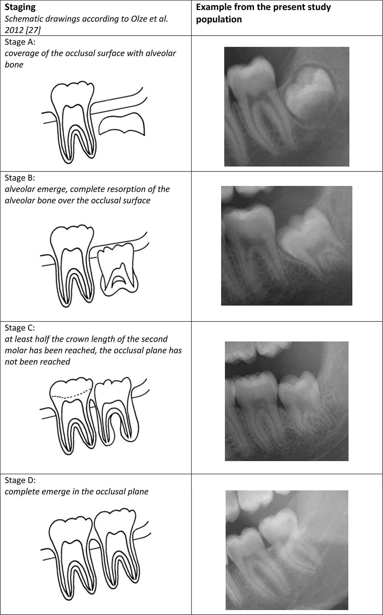 Third molar eruption in dental panoramic radiographs as a feature for forensic age assessment – new reference data from a German population