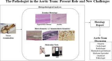 The Cardiovascular Pathologist in the Aortic Team
