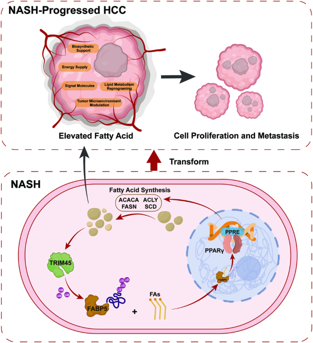 TRIM45 facilitates NASH-progressed HCC by promoting fatty acid synthesis via catalyzing FABP5 ubiquitylation