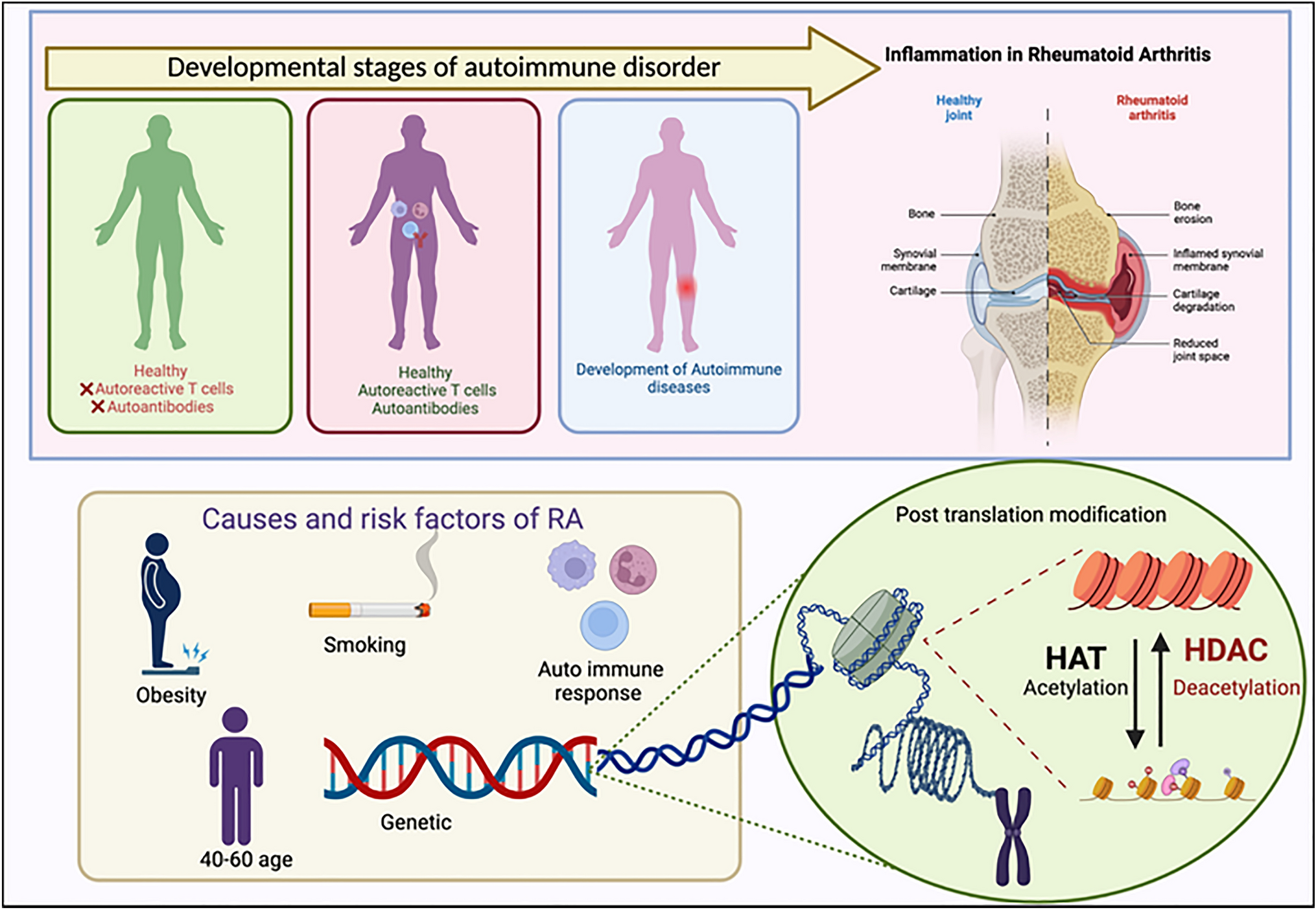 Epi-revolution in rheumatology: the potential of histone deacetylase inhibitors for targeted rheumatoid arthritis intervention