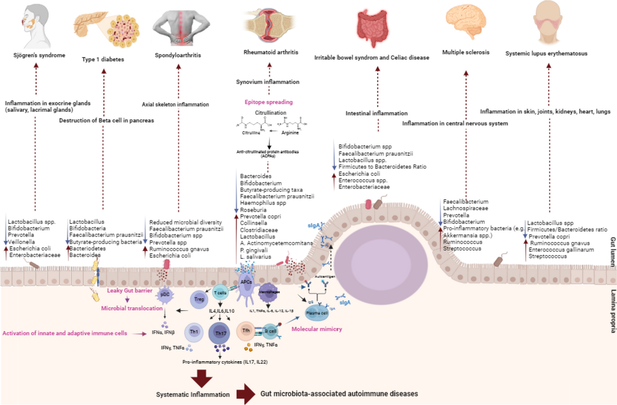 Gut Microbiota and Autoimmune Diseases: Mechanisms, Treatment, Challenges, and Future Recommendations