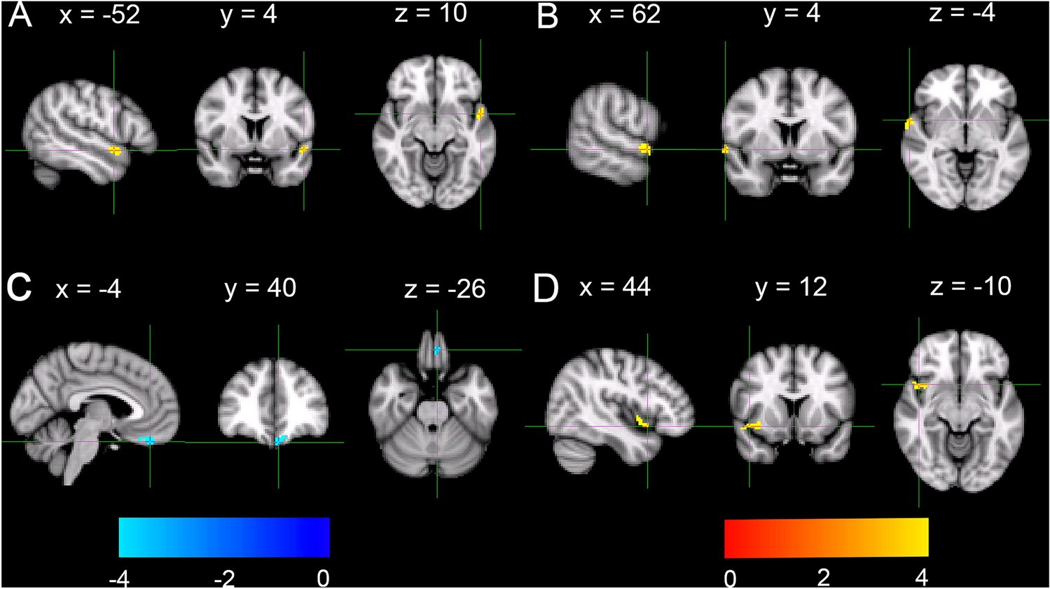 Dissociable neural correlates of trait and ability emotional intelligence: a resting-state fMRI study
