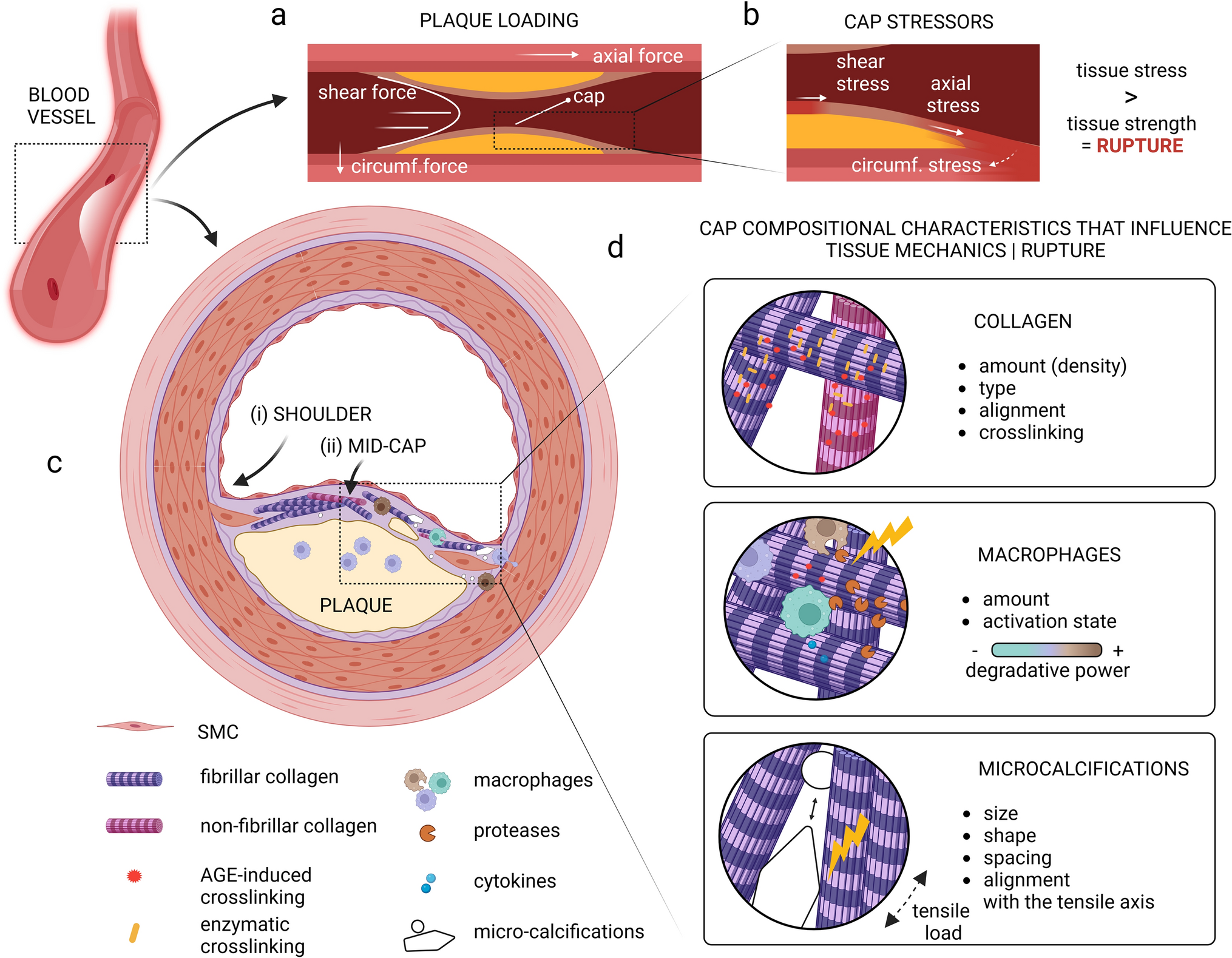 The interplay of collagen, macrophages, and microcalcification in atherosclerotic plaque cap rupture mechanics