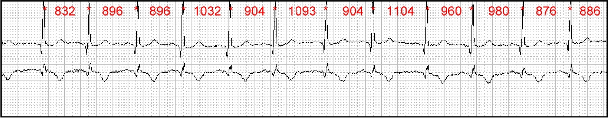 Guideline for the application of heart rate and heart rate variability in occupational medicine and occupational health science