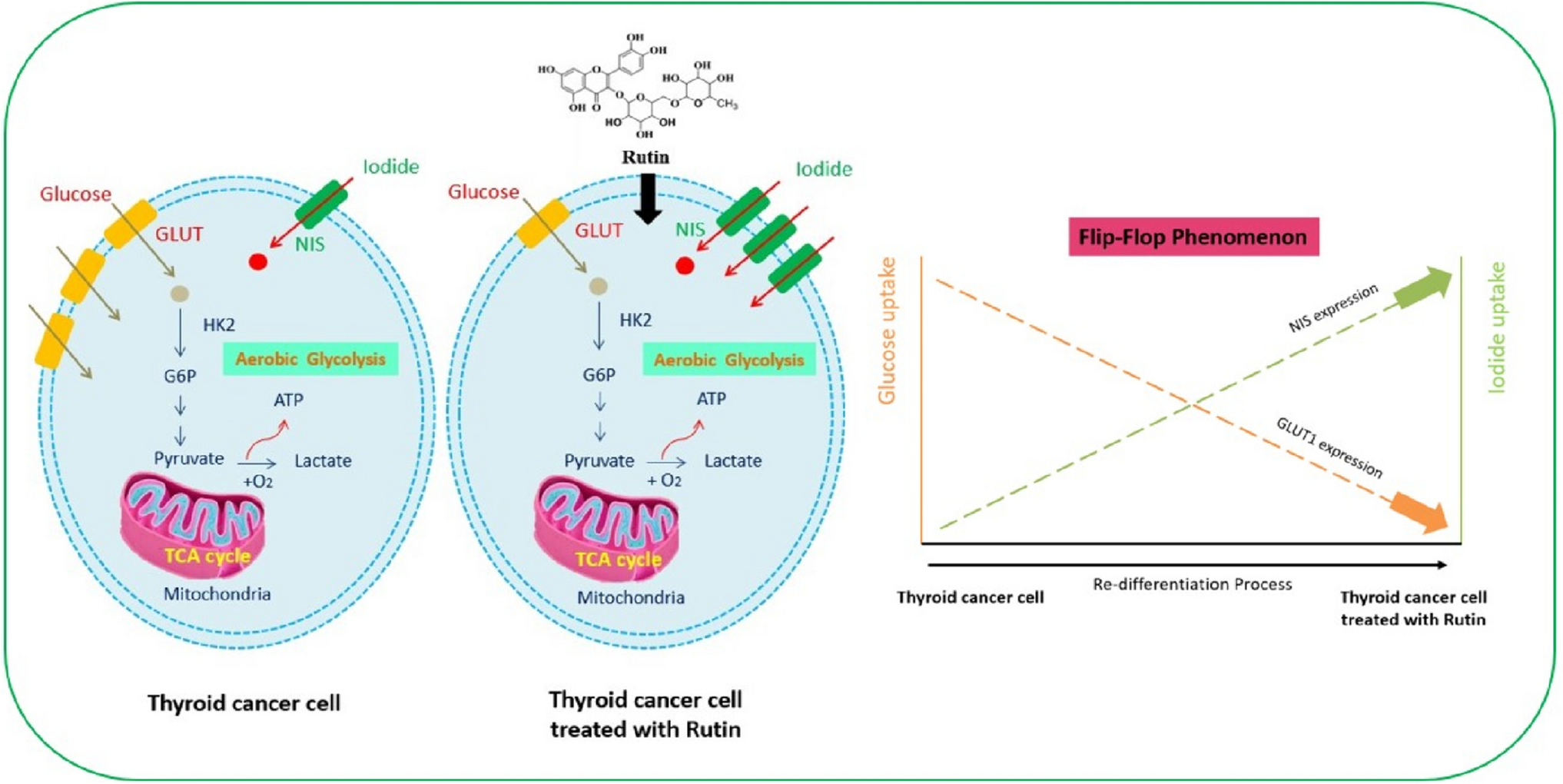 Regulation of iodine-glucose flip-flop in SW1736 anaplastic thyroid cancer cell line