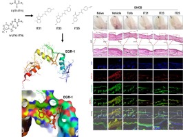 Design, synthesis, and biological evaluation of 2-(2-oxoindolin-3-ylidene)hydrazinecarbothioamides as a potential EGR-1 inhibitor for targeted therapy of atopic dermatitis